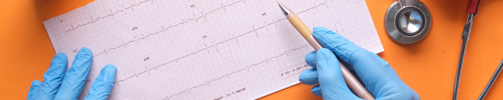 Holter EKG
